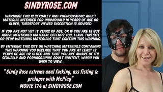 Sindy Rose extreme anal fucking&comma; ass fisting & prolapse with Mr&period;Play